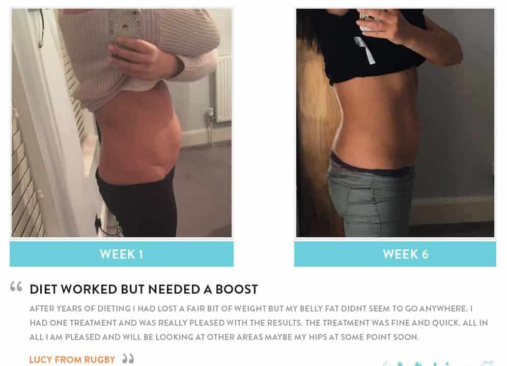 Before and After Dieting Welwyn Garden City