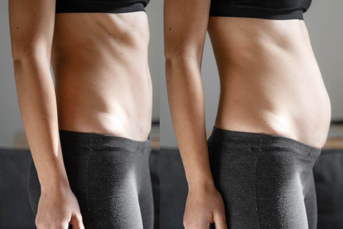How long does diastasis recti take to improve Welwyn Garden City?