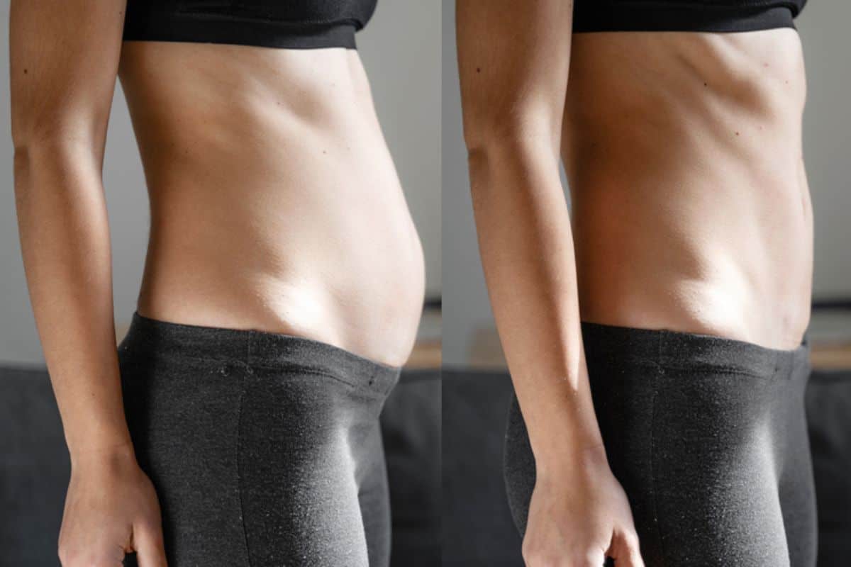 Post-Pregnancy: What Happens to Your Abdominal Muscles After Birth Welwyn Garden City