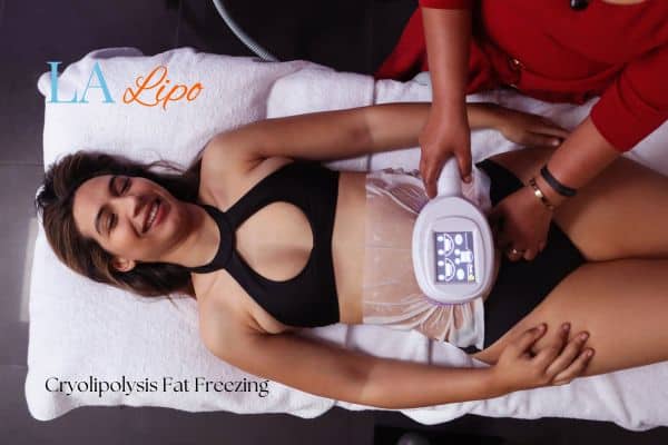woman getting cryolipolysis Welwyn Garden City