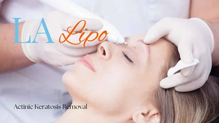 Woman receiving Actinic Keratosis Removal Treatment Welwyn Garden City