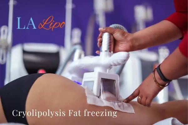 women getting fat freezing Welwyn Garden City