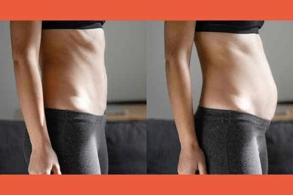 LA-EMS Body Sculpting results Welwyn Garden City
