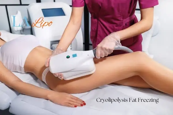 Woman receiving coolsculpting Welwyn Garden City treatment on her thighs