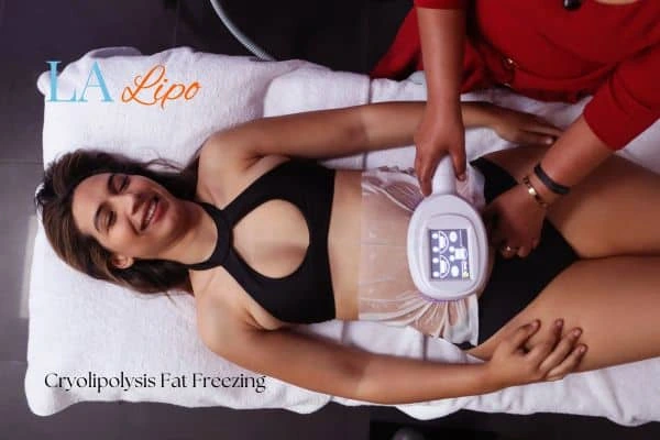 woman getting cryolipolysis Welwyn Garden City