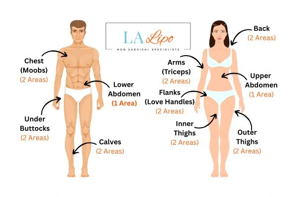 LA LIPO Cryolipolysis Areas Welwyn Garden City