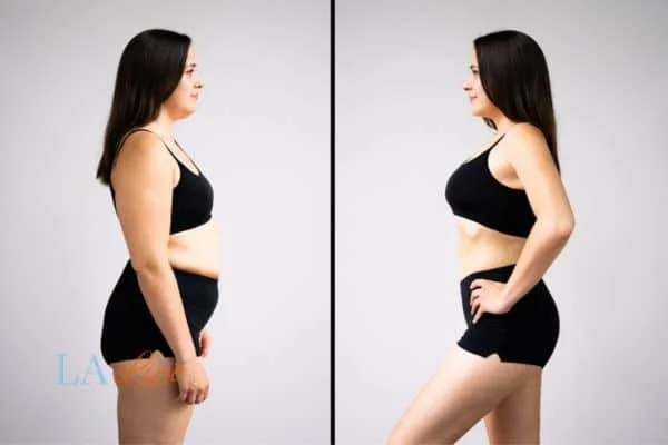 link between body image and mental health Welwyn Garden City