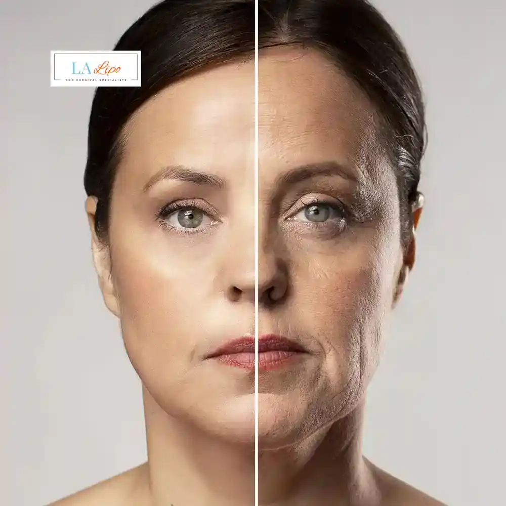 How Can You Tell If Non-Surgical Skin Tightening Is Right for You Welwyn Garden City?