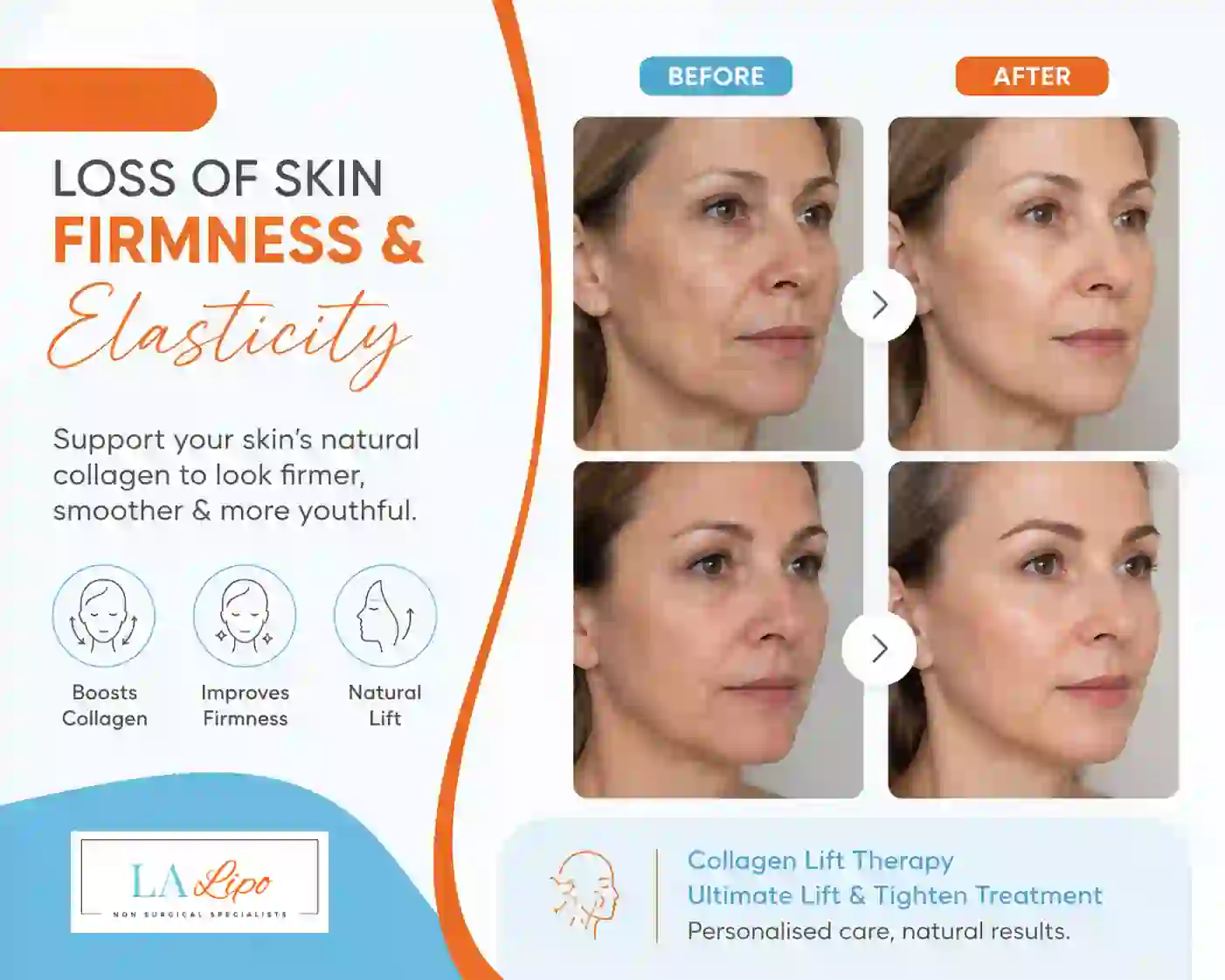 Sign #7: Loss of Skin Firmness and Elasticity Welwyn Garden City