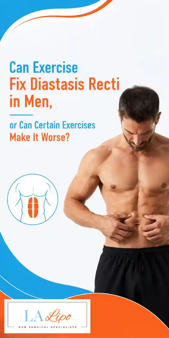 Can Exercise Fix Diastasis Recti in Men, or Can Certain Exercises Make It Worse Welwyn Garden City?