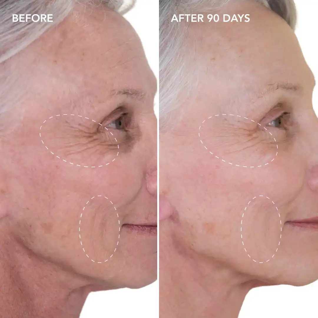 When will you see results Welwyn Garden City